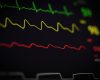 Close-up of a medical monitor displaying vital signs including heart rate and oxygen levels.