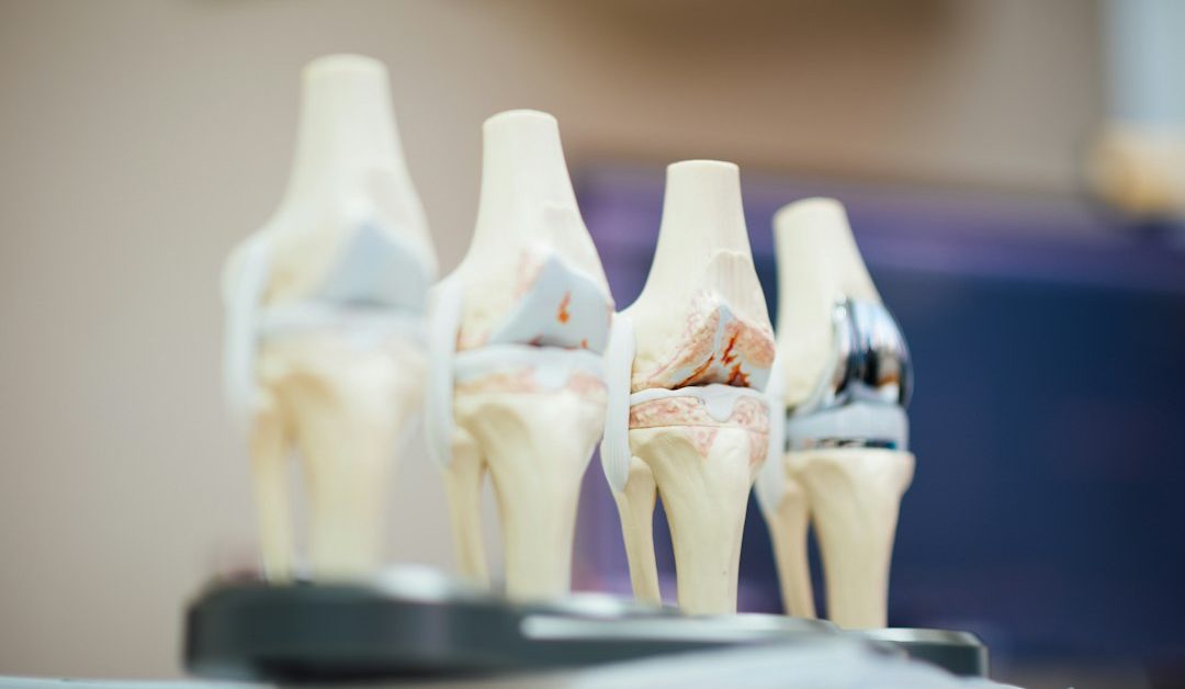 Exploring the Clinical Innovations Shaping Modern Limb Preservation
